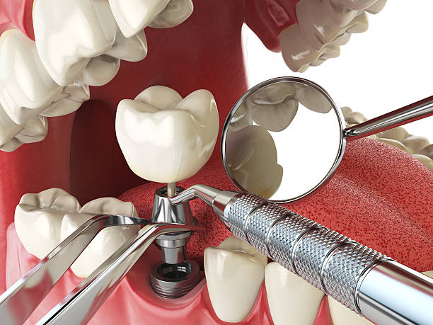 Best Emergency Treatment for Toothache in Clarion, IA